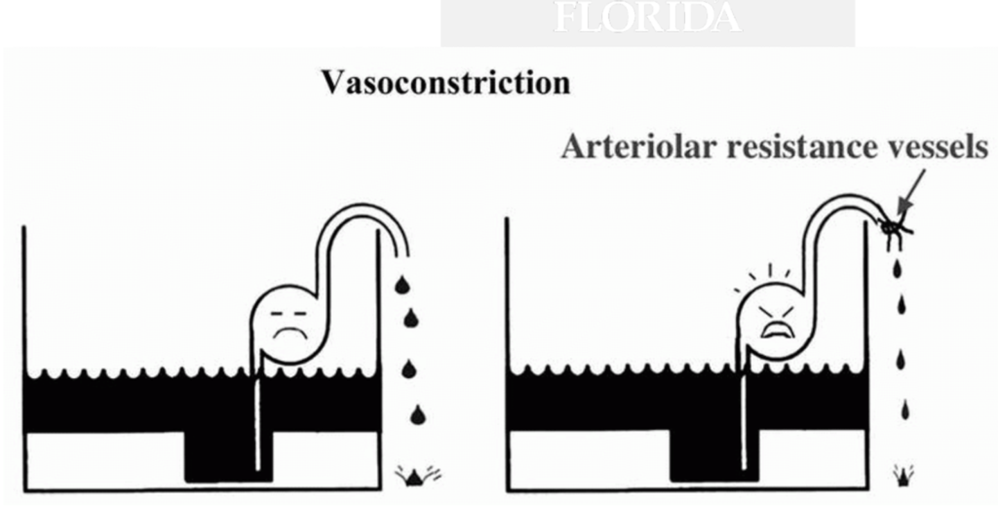 <p>Since there is a shunting of blood to vital organs (due to Ang II, NE, EPI, and vasopressin release) causes more resistance, so the heart has to work even harder</p>
