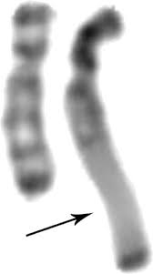 <p>Insertions of the oncogene within the normal chromosome.</p><ul><li><p>Represent hundreds of copies of amplified DNA</p></li></ul><p></p>