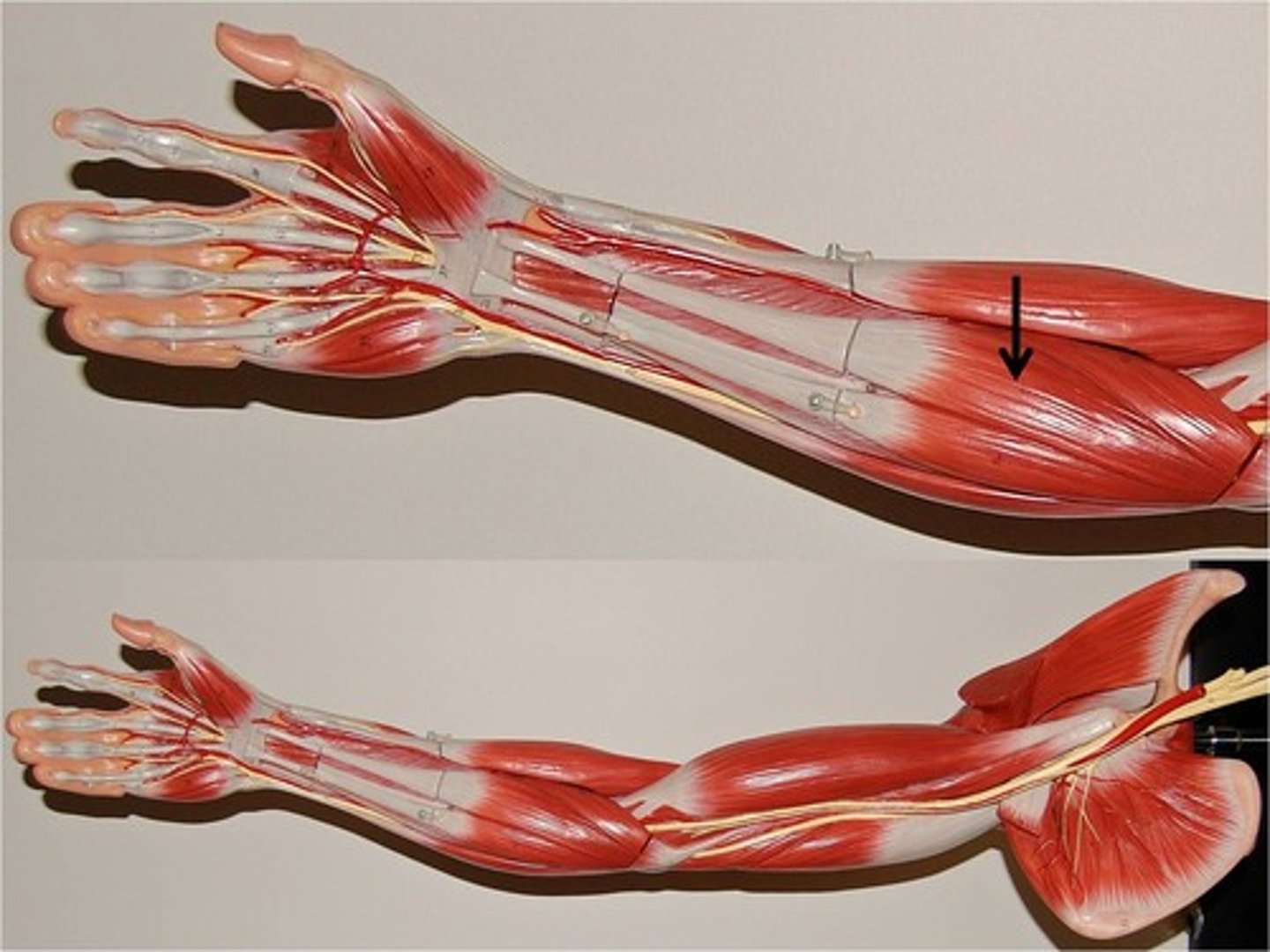 <p>flexes and abducts wrist</p>