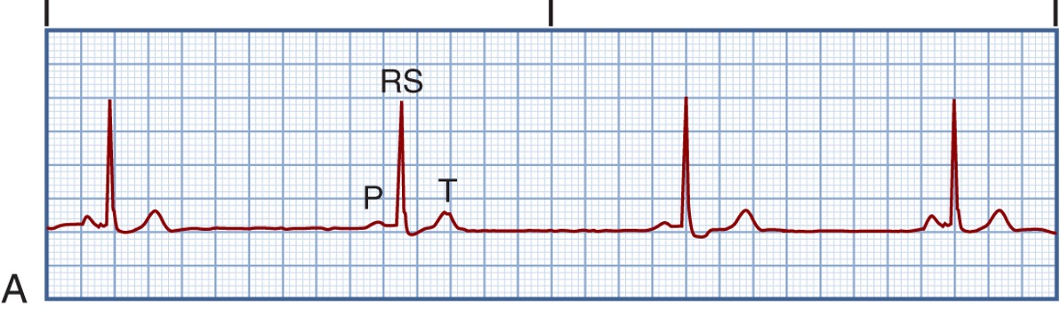 <p>What rhythm is this?</p>