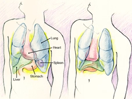 <p>Congenital agenesis of the spleen</p>