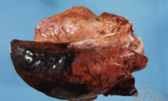 <p>A younger pig presents with sudden death attributable to bacterial septicemia. The pig had cyanotic extremities and CNS signs including tremors, shaking, and paddling. Thoughts?</p>