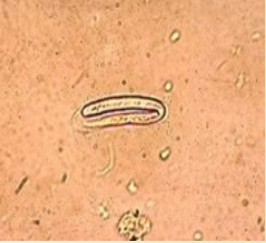 <p>habronema spp</p>