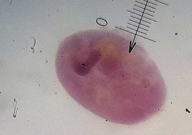<p>What protist is this?</p>