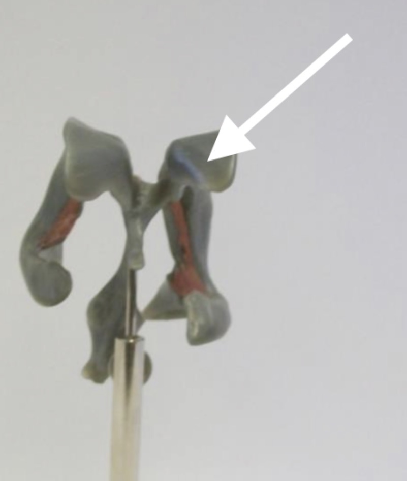 <p>What is the arrow pointing to?</p>