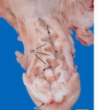 <p>Which species cervix is this?</p>