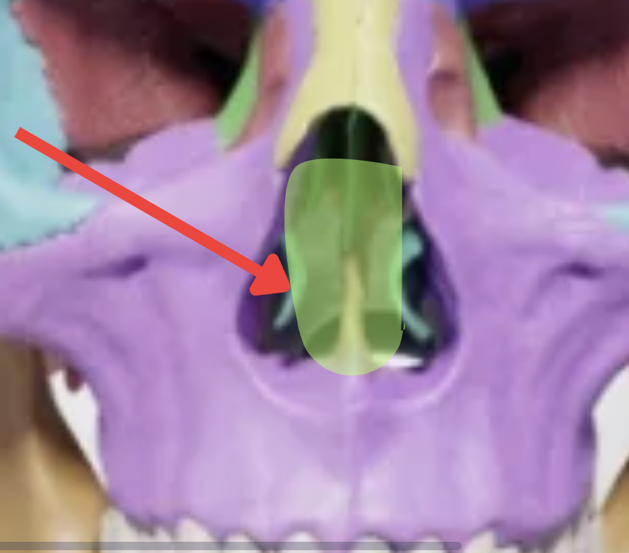 <p>Nasal septum - What is it? Bones involved?</p>