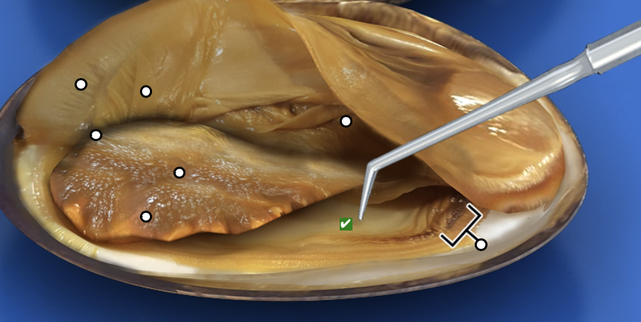 <p>What structure is this pointing to?</p>