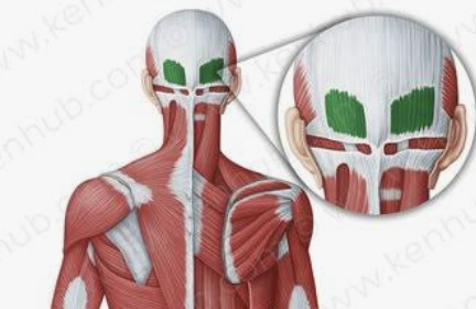 <p>Which muscle is this?</p>