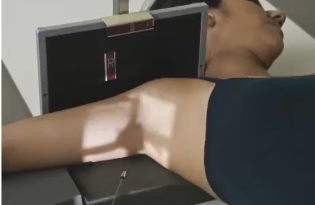 <p>(projection) Along long axis of body @ angle >10 degrees </p>