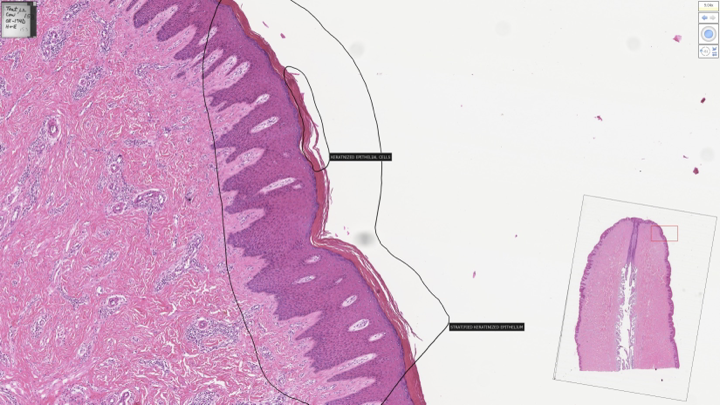 <p>stratified squamous keratinized</p>
