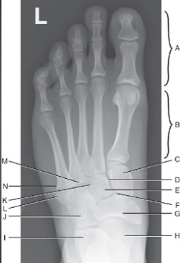 <p><strong>What does C represent in this foot image?</strong></p>