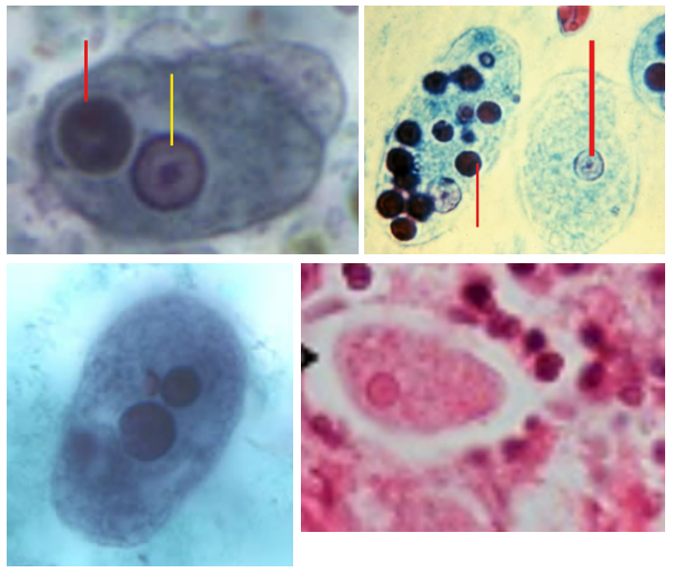 <p>Species and what stage:<br>Infective Stage:<br>Diagnostic Stage: <br>Pathognomonic finding: <br>MOT: <br>Lab Diagnosis:<br>Pathogenicity:<br>Treatment:<br>Red Line:<br>Yellow Line:</p>