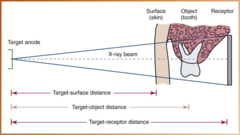 <p>The distance from the source of radiation to the tooth</p>