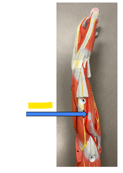 <p>What is the yellow arrow?</p>