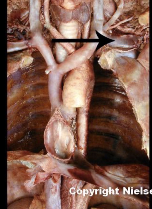 <p>The indicated vessel is the _</p>