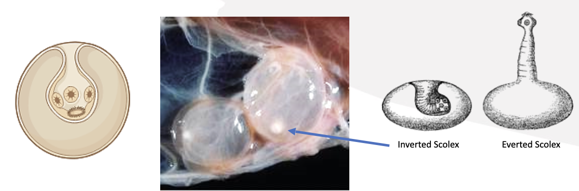 <p>What type of metacestode stage is this? </p>