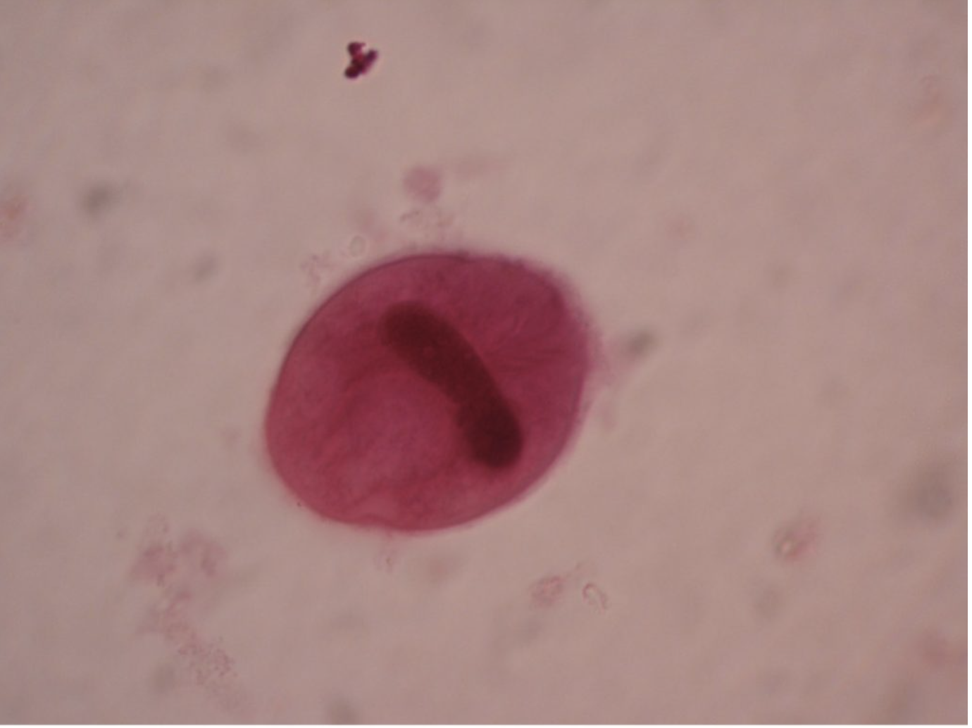 <p><span>Fecal-oral (pigs); only ciliated human parasite, largest intestinal protozoan</span></p><p class="text-body text-secondary">Distinguish by cilia and huge size compared to other protozoa.</p>