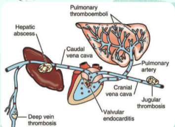 <p>What circulatory disturbance refers to both local thrombus formation and the translocation of a clot from the venous circulation into the lungs?</p>