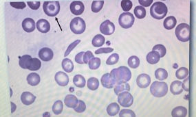 <p>Identity the RBC at the BLACK arrow?</p>