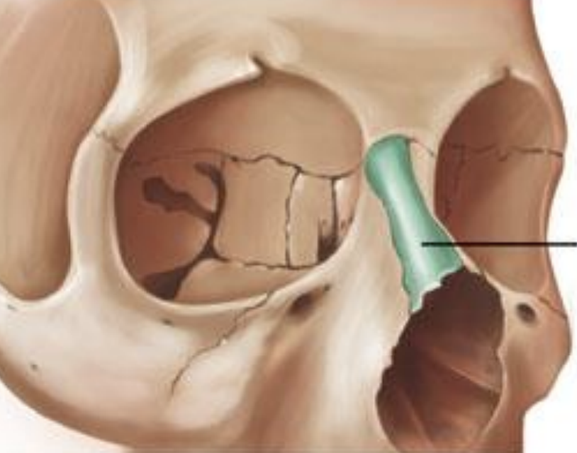 <p>what bone is highlighted in green</p>