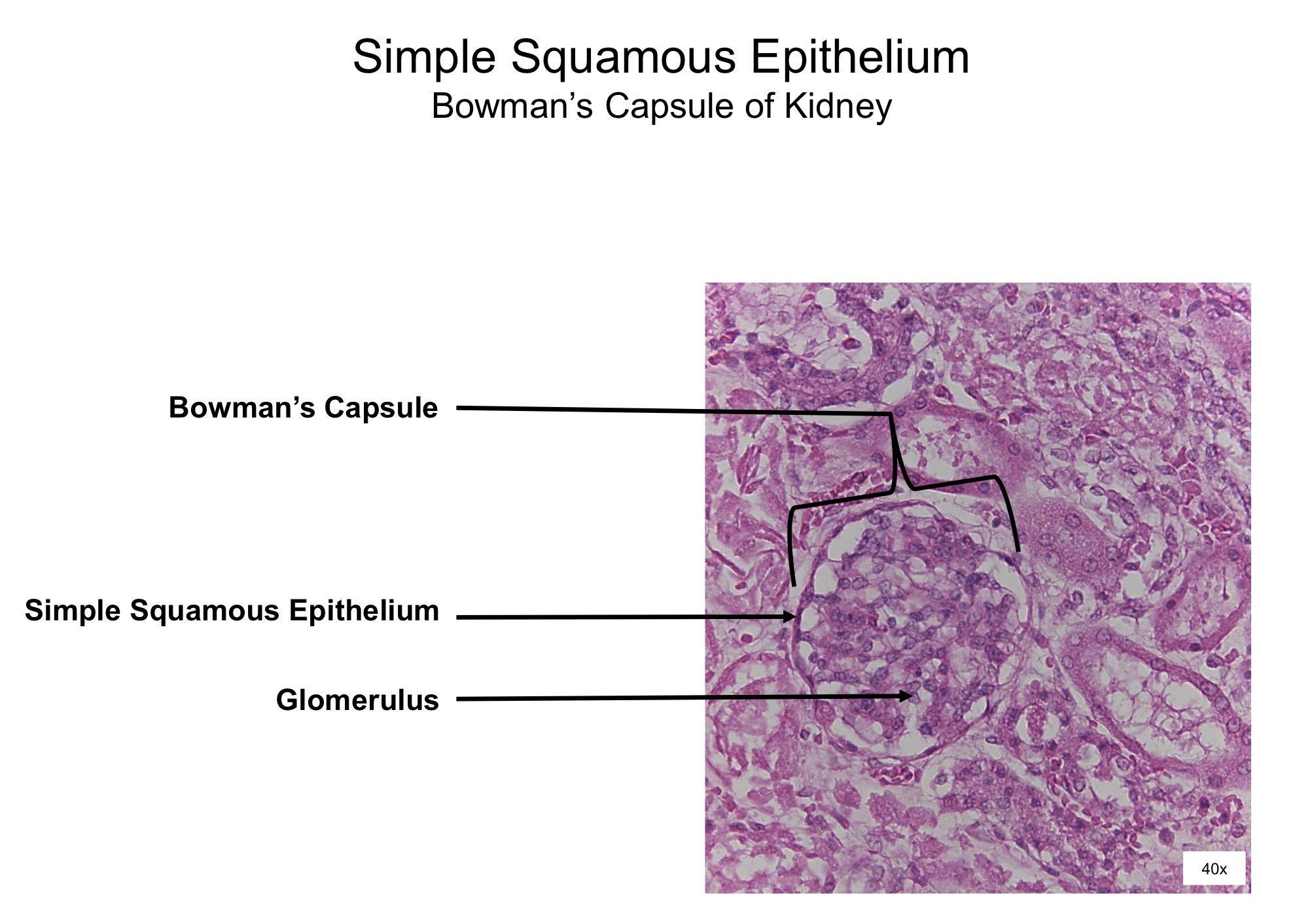 <ol><li><p>Bowman’s capsule </p></li><li><p>Simple squamous epithelium </p></li><li><p>Glomerulus </p></li></ol><p></p>