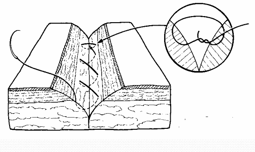 term image