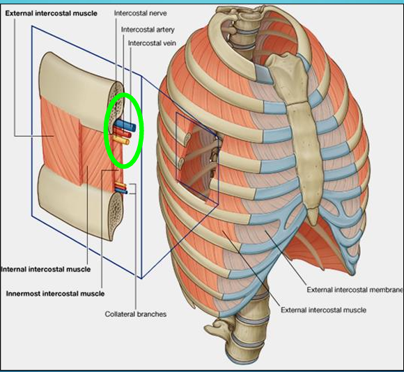 <ul><li><p><strong>Intercostal Bundle (V.A.N)</strong> The neurovascular bundle is organized from superior to inferior as the <strong>intercostal vein, intercostal artery, and intercostal nerve</strong>.</p></li></ul><ul><li><p><strong>Location:</strong> It is situated within the <strong>costal groove</strong> along the inferior border of each rib, running between the <strong>internal and innermost intercostal muscles</strong></p></li></ul><p></p>