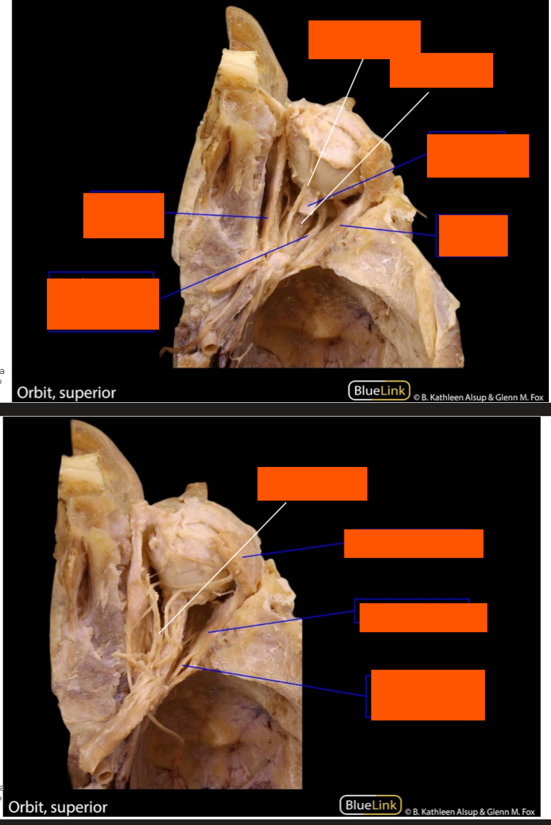 <p>Label this prosection</p>