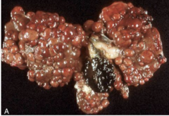 <p>How would you describe this liver?</p>