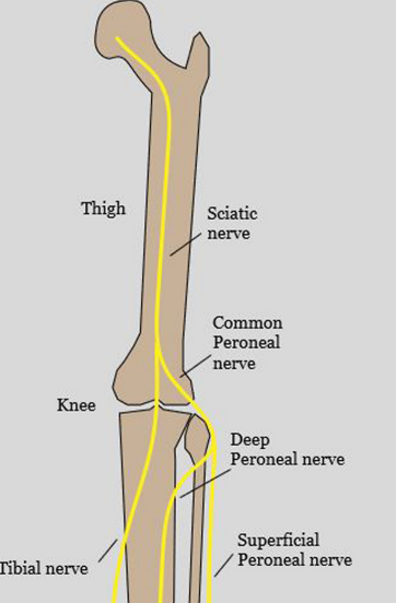 <p>Wraps the fibular neck laterally; at risk when correcting a valgus or flexion deformity.</p>
