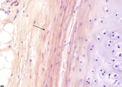 <p>identify the tissue</p>