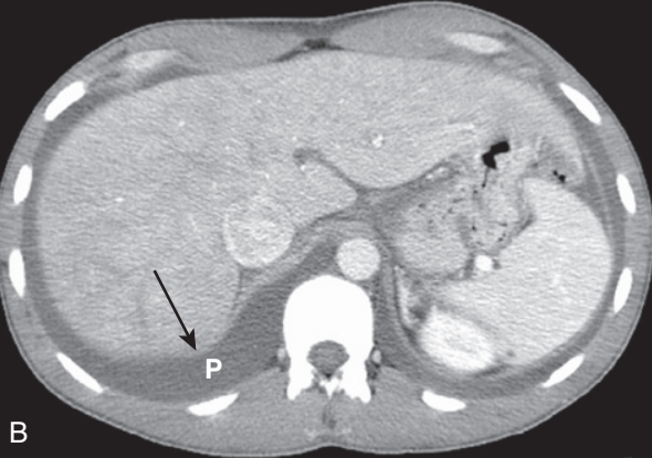<p>diagnosis</p>