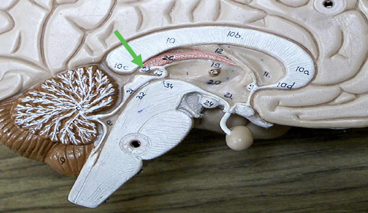 <p>Identify the area of the brain indicated by the pointer.</p>