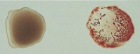 <p>What type of blood is this?</p>