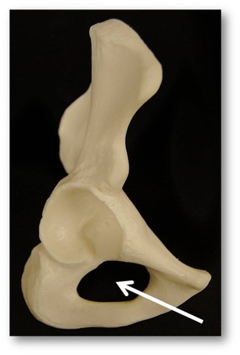 <p>- Opening in the os coxae</p>