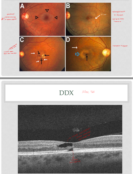 <p>Mac tel 2 findings (Slide 14-17)</p>