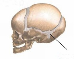 <p>soft spot between the skull bones of an infant</p>