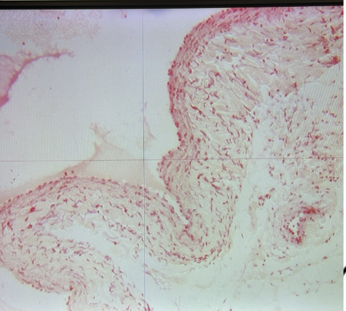 <p>What’s the small white opening where blood travels through?</p>