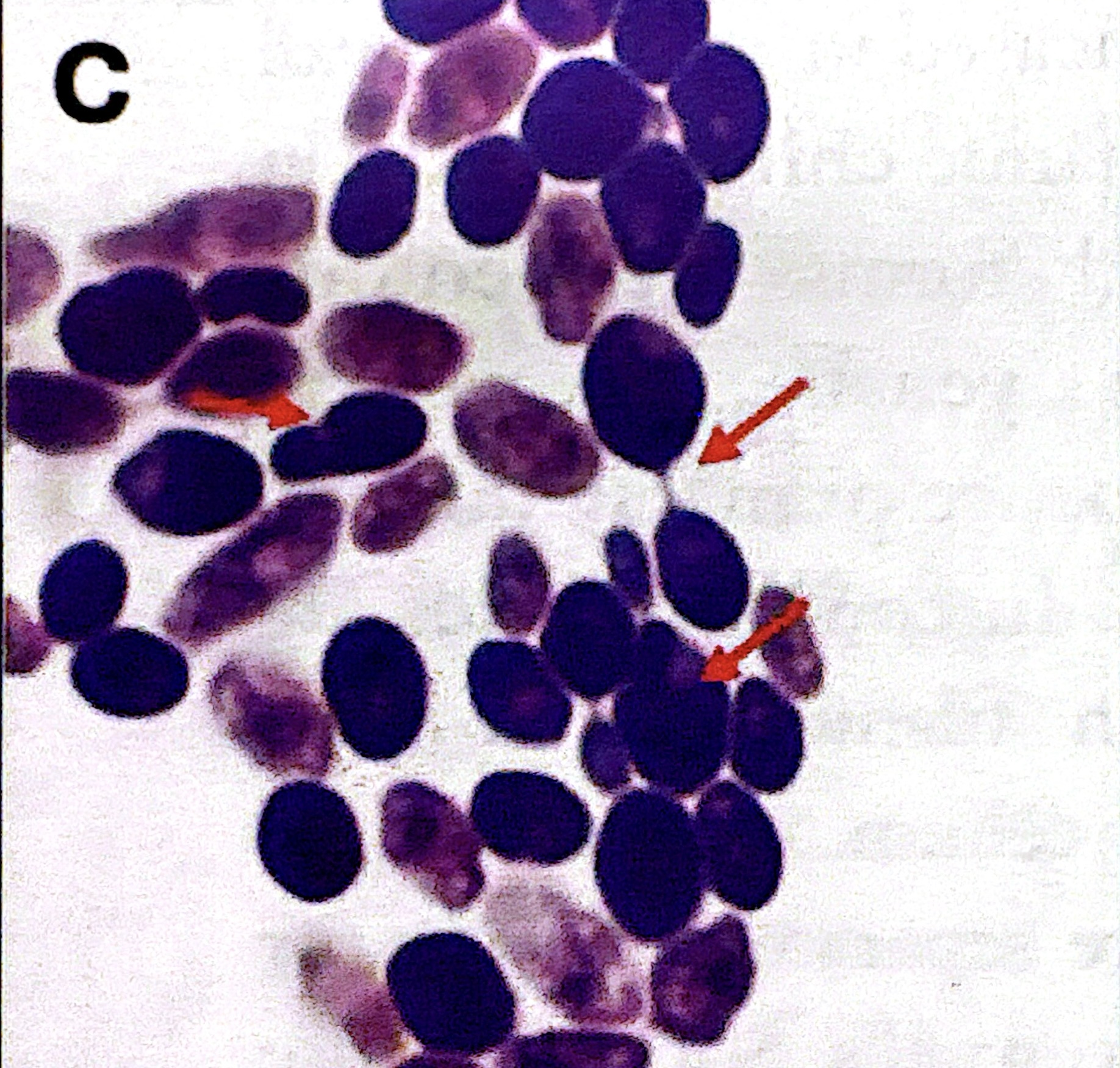 <p>budding yeast. Oval shaped and reproduce through asexual budding (“budding” yeast) </p>