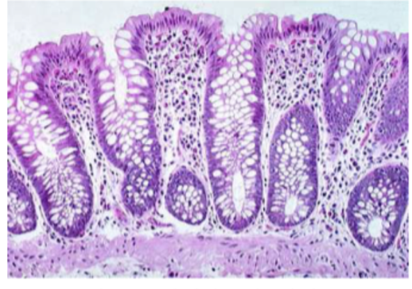 <p>Goblet cells</p>