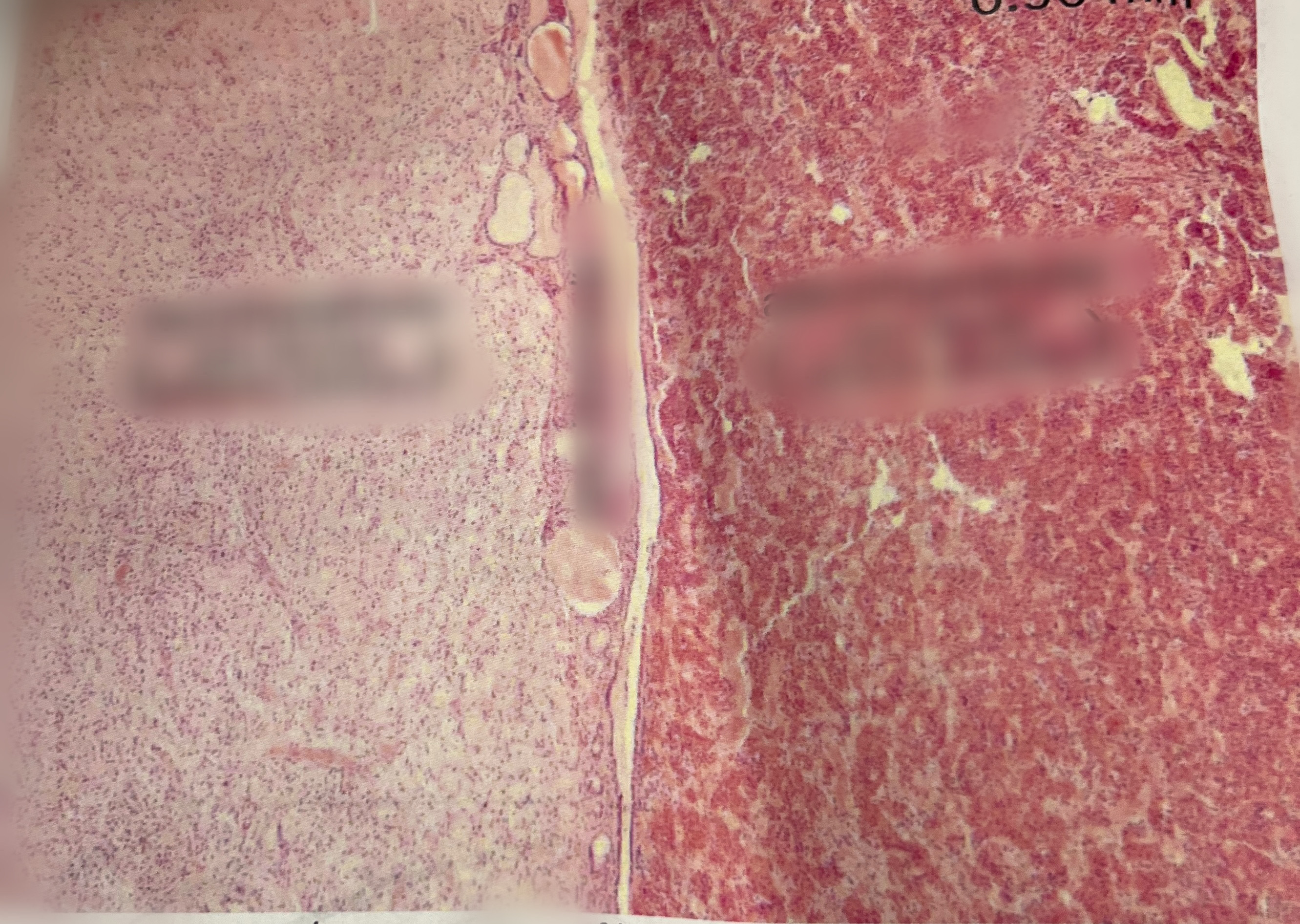 <p>What is the left/lighter pink side of the pituitary gland called?</p>