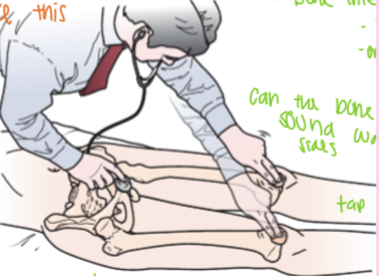 <ul><li><p><strong>Purpose:</strong> Assesses for <strong>periacetabular, iliopubic, ischiopubic ramus, and femoral fractures</strong>.</p></li><li><p><strong>How:</strong> Patient supine. Place the <strong>bell of the stethoscope over the pubic symphysis</strong>, then <strong>percuss each patella</strong> and compare the <strong>pitch and loudness</strong> between sides.</p></li><li><p><strong>Positive:</strong> <strong>A duller sound on the affected side</strong>, indicating <strong>bone pathology (e.g., hip or femoral fracture)</strong>.</p></li></ul><p></p>