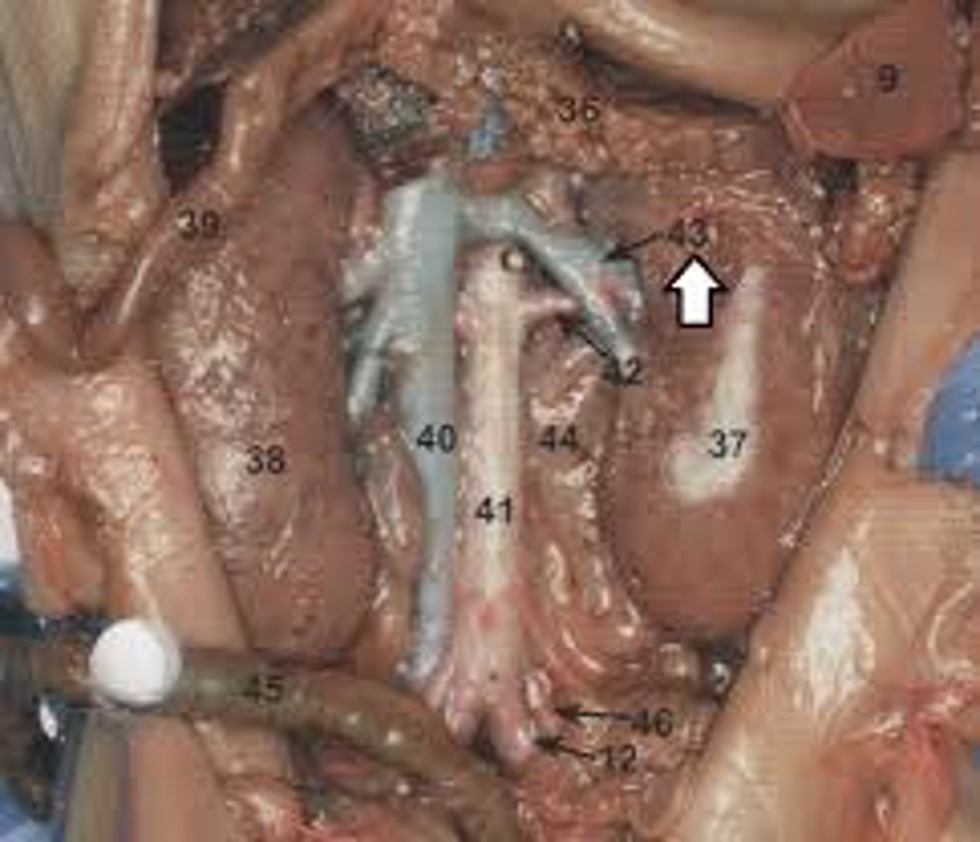 <p>pertaining to the kidney (43; right and left)</p>