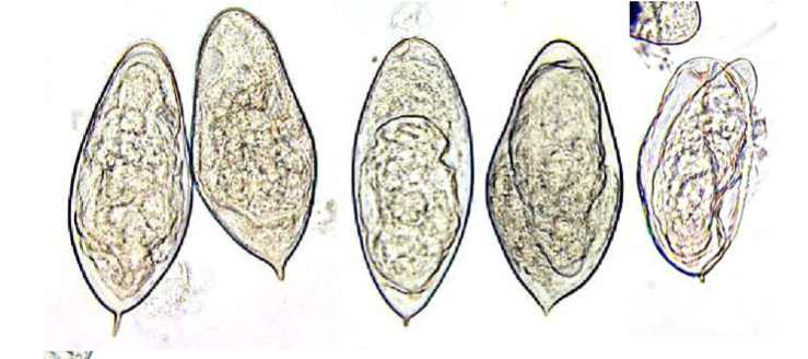 <p>Keywords for Schistosoma haematobium</p>