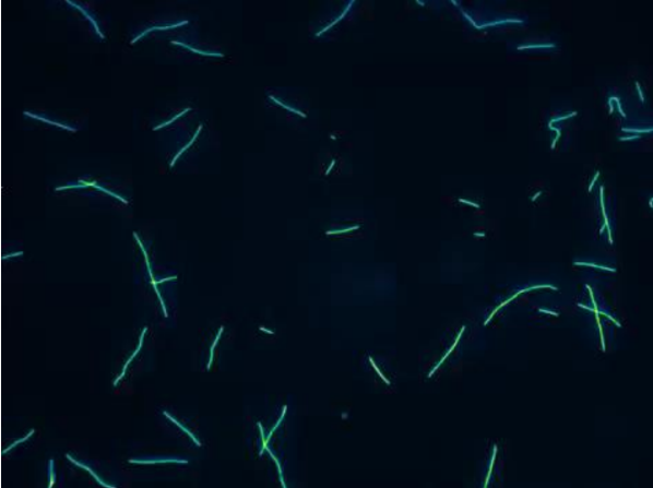 <p>MT Gliding Assay = demonstrate Kinesin motor function </p><ul><li><p>Tails = attached to coverslips</p></li><li><p>Head = exposed </p><ul><li><p>Fluorescent MTs moved around by head </p></li></ul></li><li><p>Generally = Kin-N Kinesins (walk to (+) end)</p><ul><li><p>(-) end MT = leading movement </p></li></ul></li><li><p>Kin-C Kinesin (walk to (-) end)</p><ul><li><p>(+) end MT = leading movement</p></li></ul></li></ul><p></p>