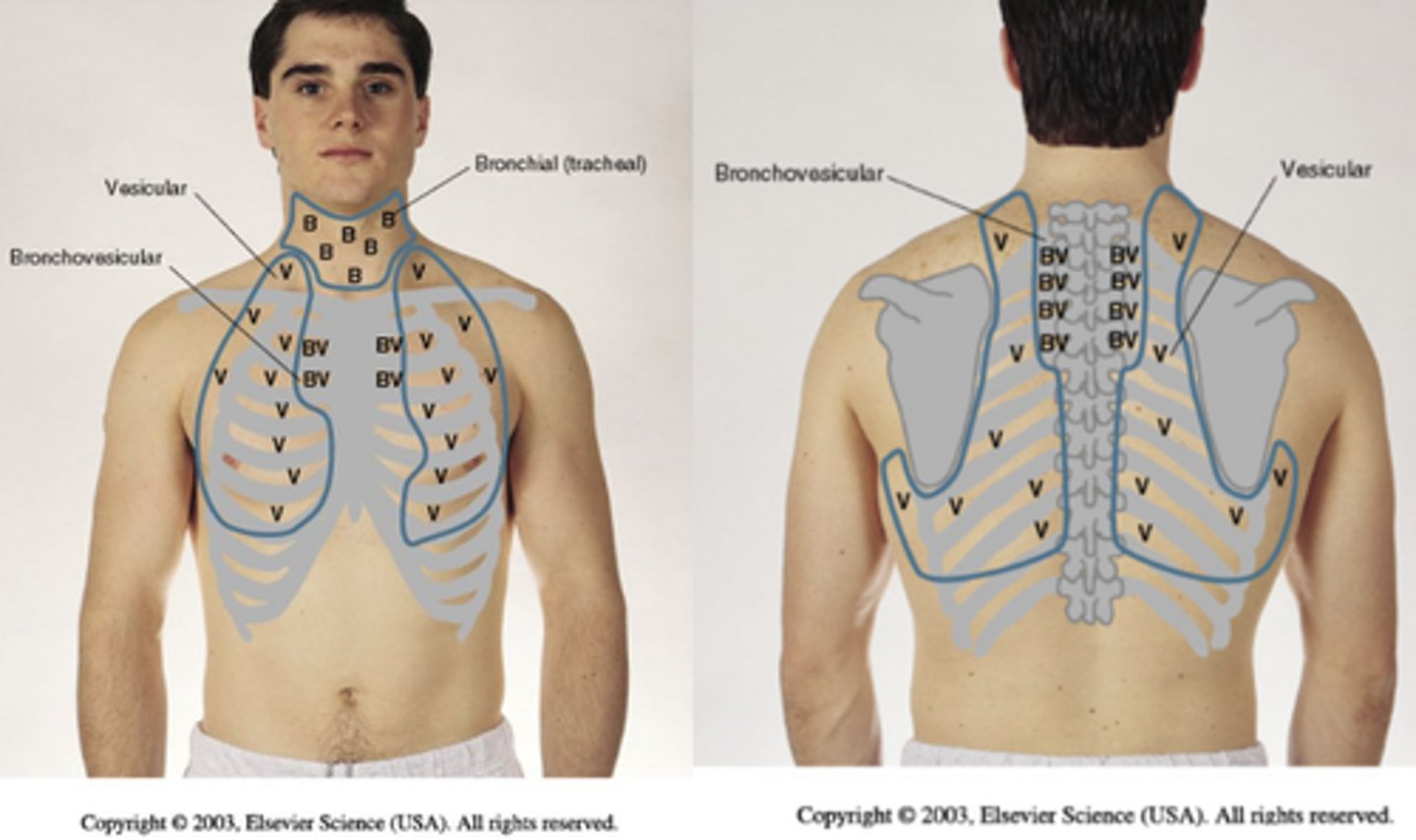 <p>loud, high pitched and hollow, heard over the manubrium, prolonged in the expiratory phase</p>