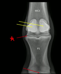 <p>How do you diagnosis metacarpophalangeal (fetlock) joint OA?</p>
