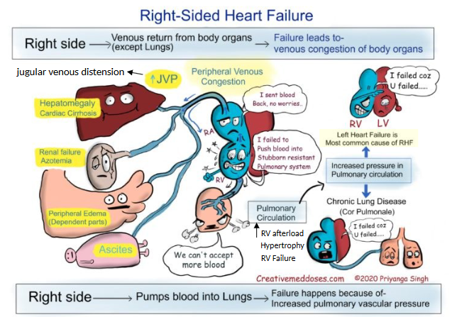 <ul><li><p>hepatomegaly (cardiac cirrhosis), renal failure, peripheral edema, ascites (abdominal distension)</p></li><li><p>failure for venous return from organs → <strong>venous congestion of body organs</strong></p></li><li><p>inc. pulm. vasc. resistance → <strong>failure of blood to pump to lungs</strong></p></li></ul><p></p>
