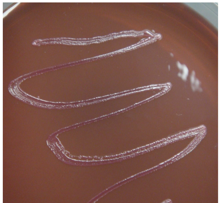 <p>if it’s pink or red did it <strong>ferment</strong> lactose or no? emb</p>